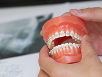 美しい歯並びになる以外にも、矯正は様々なメリットがあります